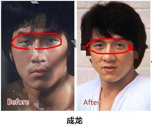成龙爆料双眼皮视频,揭秘明星整形背后的真相 第3张 成龙爆料双眼皮视频,揭秘明星整形背后的真相 第3张